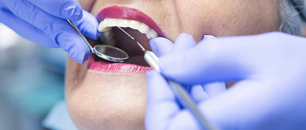 Best Emergency Tooth Extraction in North Beach, MD